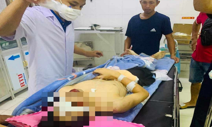Hà Tĩnh: Nam sinh 17 tuổi dập nát bàn tay sau tiếng nổ lớn
