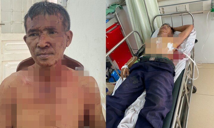 Bảo vệ ngân hàng ở Bà Rịa - Vũng Tàu bị đồng nghiệp đâm trước trụ sở