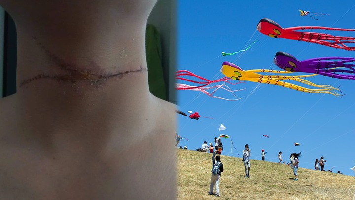 Dây diều chém đứt vỏ ô tô, cứa cổ người đi đường: Chủ diều có thể bị phạt tù