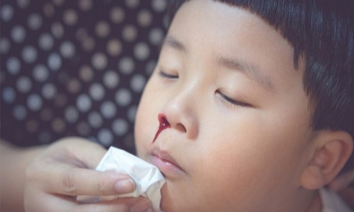 Bà nội suýt hại tính mạng cháu trai 3 tuổi khi xử lý chảy máu cam