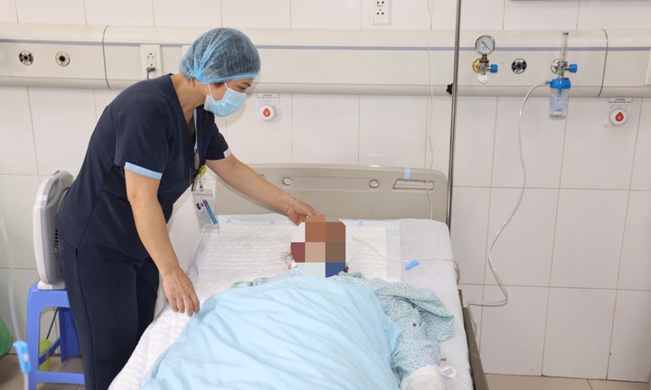 4 nạn nhân bỏng nặng sau vụ nổ trên đường Yên Phụ