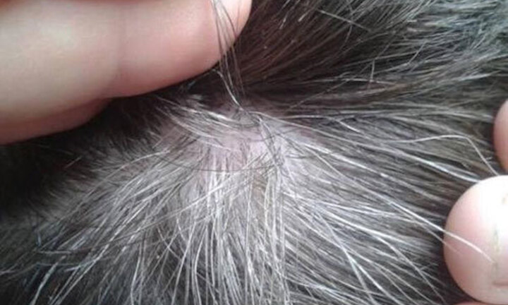 Lợi ích của việc để tóc bạc