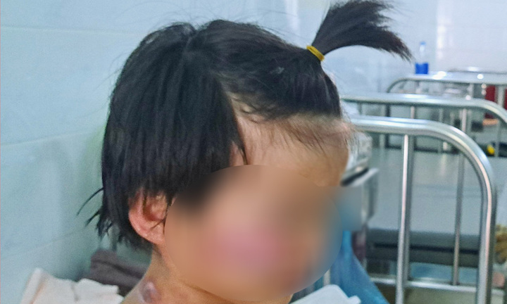 Sức khỏe 4 trẻ mắc kẹt trong vụ cháy nhà ở Tây Ninh hiện ra sao?