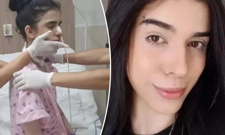 Hít phải ớt siêu cay, cô gái bị phù não, hôn mê nhiều ngày