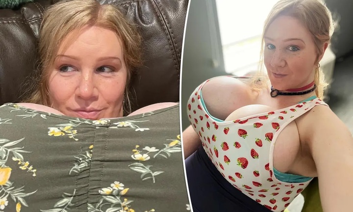 Người phụ nữ chuyển giới có bộ ngực nặng bằng đứa trẻ 