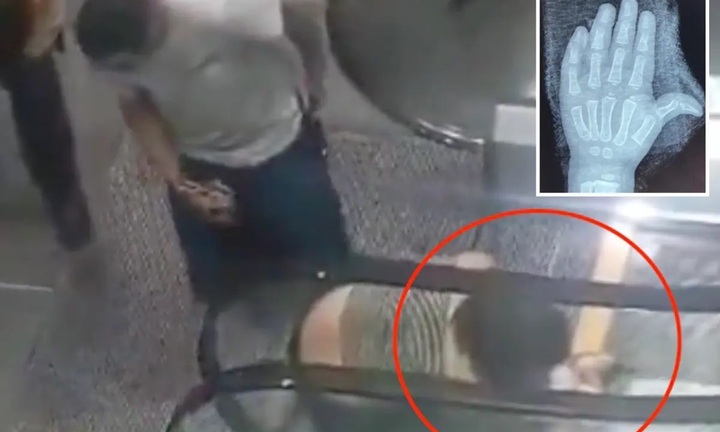 Mắc kẹt trong thang cuốn, bé gái 2 tuổi suýt mất bàn tay