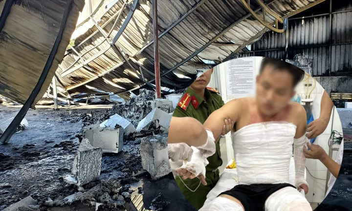 Chiến sỹ PCCC bị bỏng nặng khi chữa cháy ở Ninh Thuận 