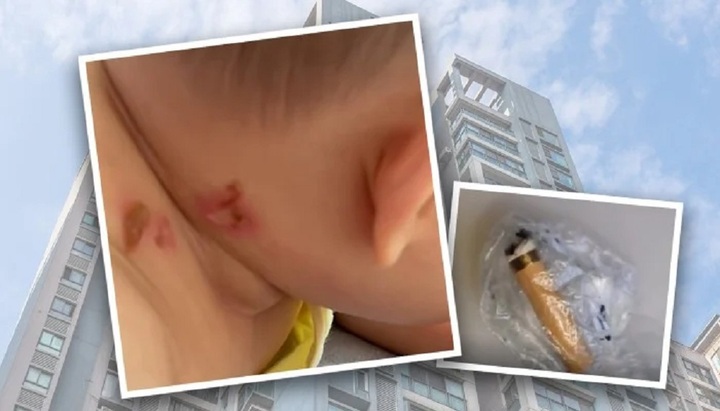 Xét nghiệm ADN dân cư cả tòa nhà 26 tầng tìm kẻ ném thuốc lá làm em bé bệnh nặng