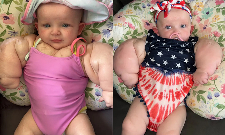  Bé gái 9 tháng tuổi có thân thể như vận động viên thể hình 