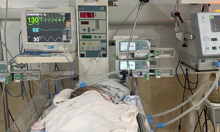 Mắc virus lây qua nụ hôn, trẻ 39 ngày tuổi nguy kịch