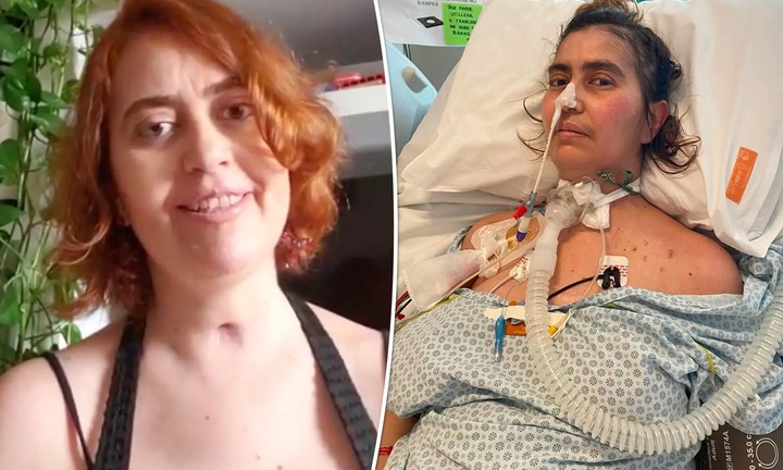 Người phụ nữ hôn mê, tê liệt toàn thân sau khi ăn đồ hộp hết hạn