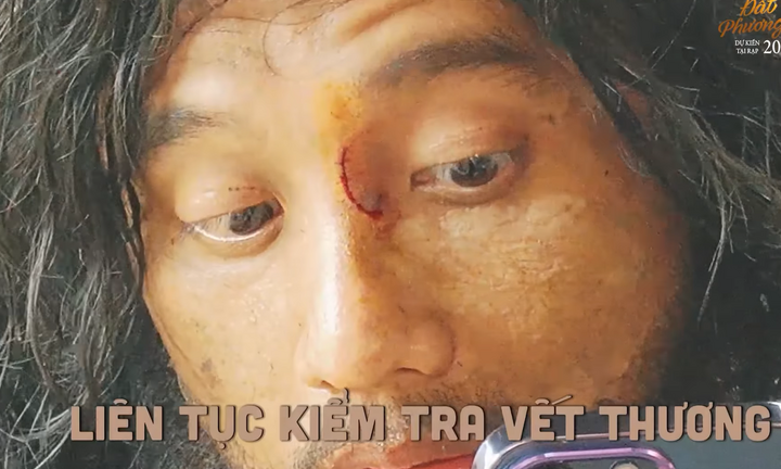 Mai Tài Phến bị rách mũi trên phim trường 'Đất rừng phương Nam'