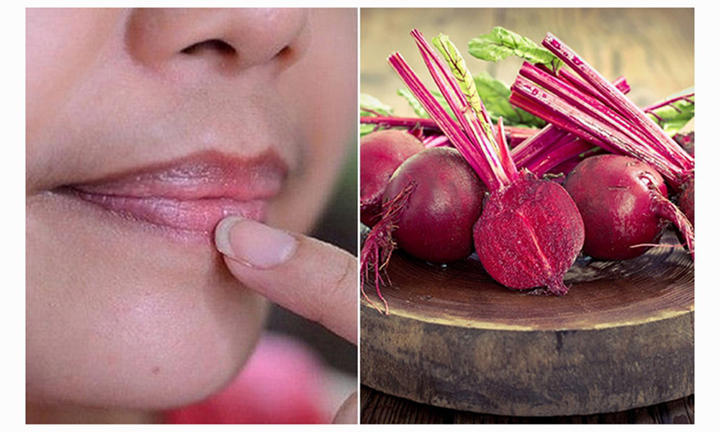 Có nên dùng củ dền đỏ trị thâm môi?
