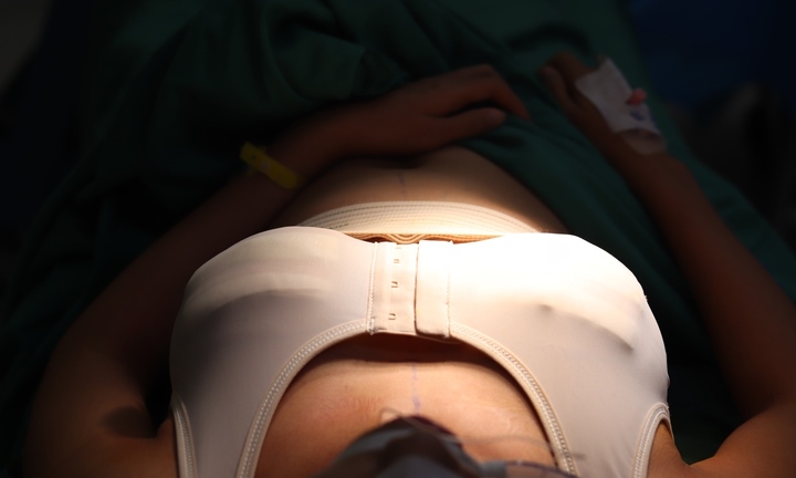 Nâng ngực bị sẹo, nguyên nhân do đâu?