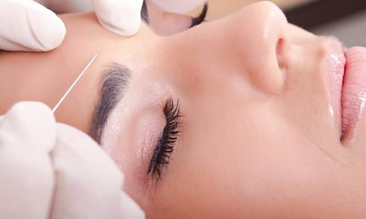 Nâng cung chân mày được bao lâu?