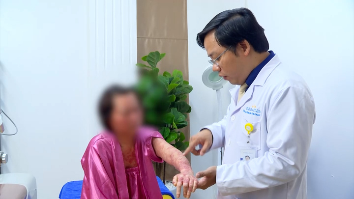 Sưng nề, mưng mủ toàn thân vì tự ý điều trị vẩy nến