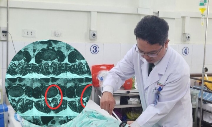 Bạn trẻ đau thắt lưng vùng thấp, bác sĩ chỉ cách phòng ngừa