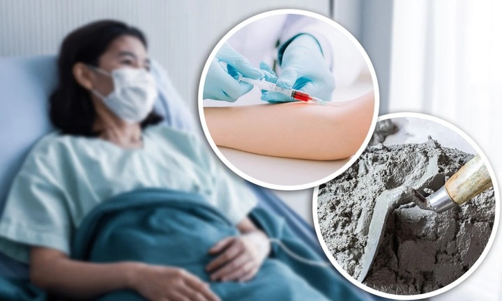 Lang băm chữa ung thư bằng xi măng khiến người phụ nữ tử vong