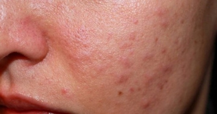 Những nguy cơ về sức khỏe khi mua mỹ phẩm trực tuyến