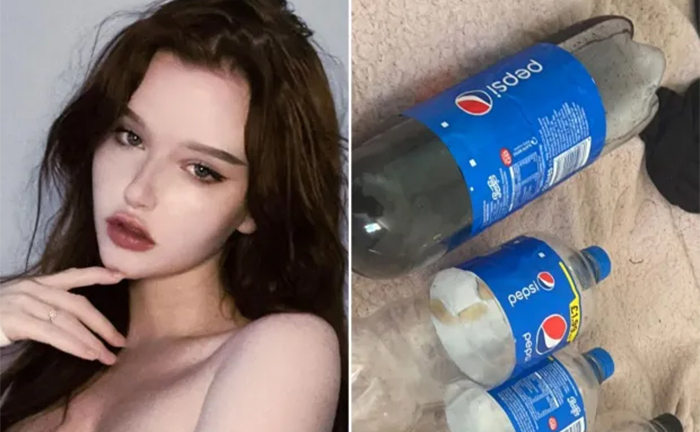 Cô gái nghiện Pepsi đến mức uống 4 lít/ngày, nếu không uống sẽ ốm nặng