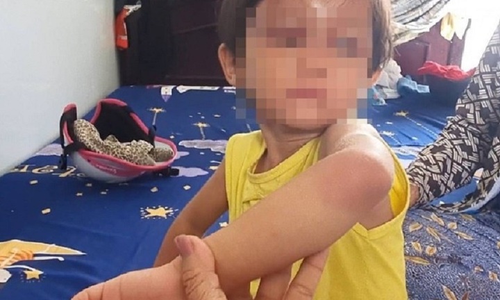 Làm rõ vụ bé gái 4 tuổi ở Cà Mau nghi bị cha nuôi đánh gây thương tích