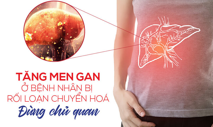 Đừng chủ quan trước tăng men gan ở bệnh nhân rối loạn chuyển hóa