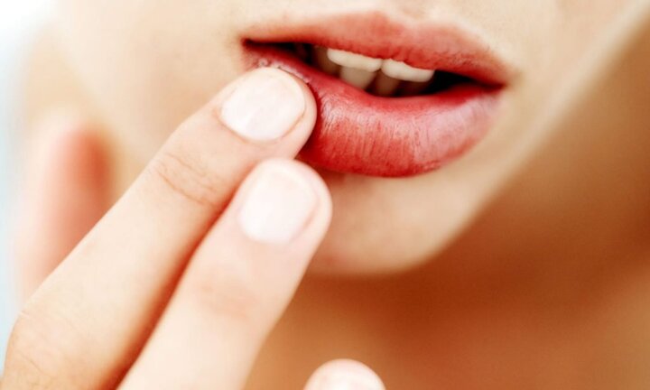 Tại sao môi bạn bị sưng khi vừa thức dậy?