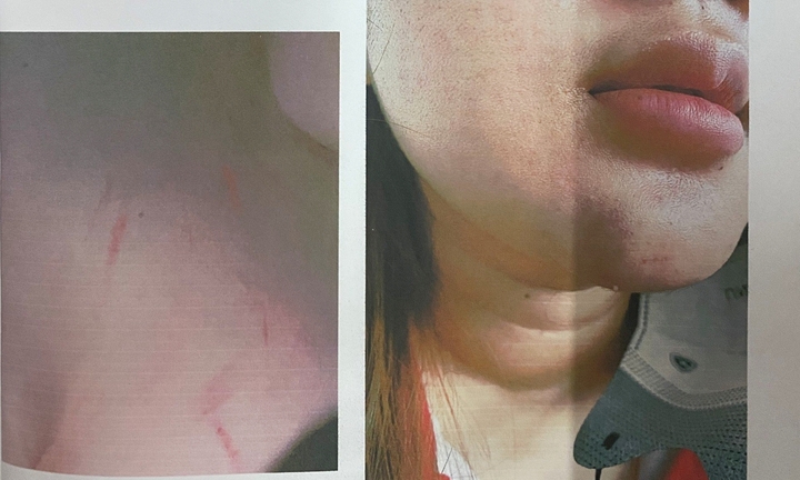 Bị nhóm phụ huynh đánh hội đồng, nữ sinh lớp 12 ở TP.HCM 'kêu cứu'