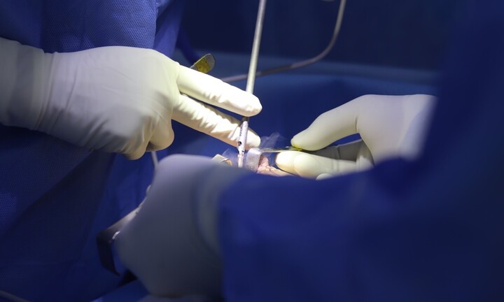 Cách kiểm tra co thắt bao xơ sau nâng ngực