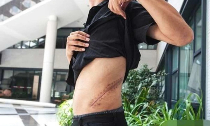 Cuộc sống bi thảm của nam sinh bán thận mua iPhone 