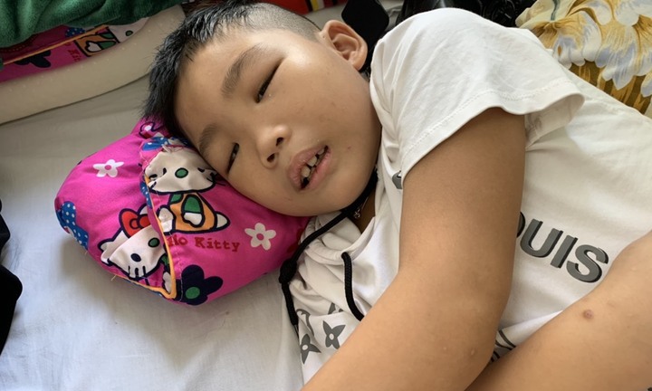 Con biến dạng khuôn mặt vì ung thư, bố mẹ vét cả gia sản không đủ tiền chạy chữa