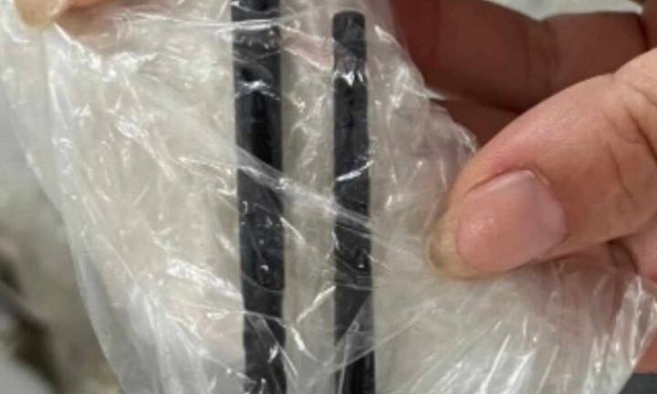 Người đàn ông ở Quảng Bình bị đũa đâm xuyên mũi sang não suốt 5 tháng