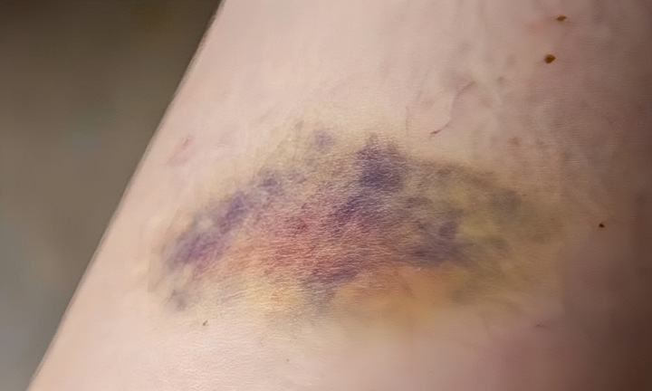 Bình Định: Phát hiện cụ bà 97 tuổi chết trên giường với nhiều vết thương