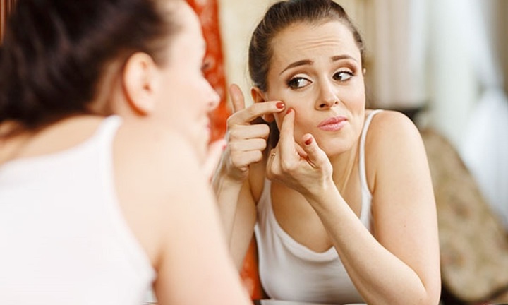 Vì sao mặt tự nhiên nổi nhiều mụn trứng cá?