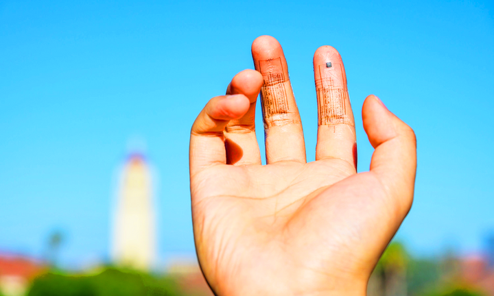 Công nghệ cấy ghép da tiết insulin đẩy lùi bệnh tiểu đường thành công