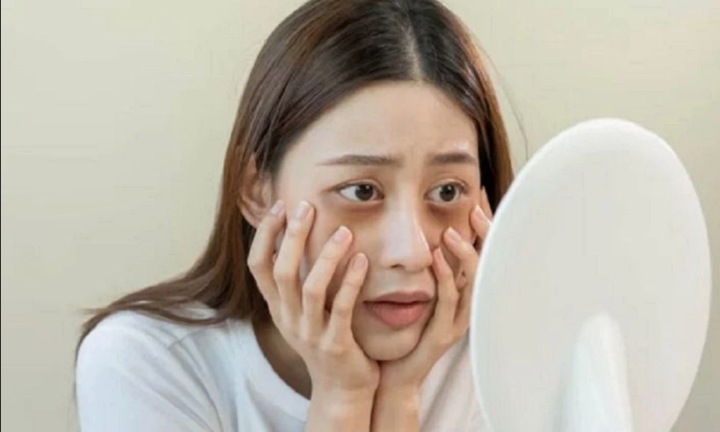 Cách khắc phục quầng thâm dưới mắt