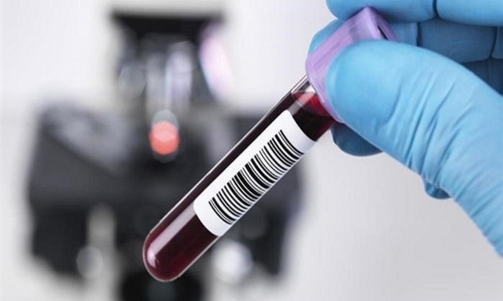 Xét nghiệm nồng độ cồn trong máu nhằm mục đích gì?