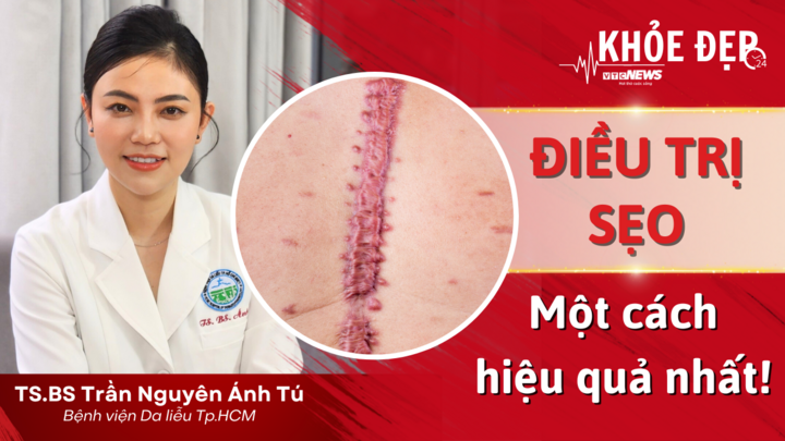 Khỏe đẹp 24h: Cách điều trị sẹo xấu hiệu quả nhất