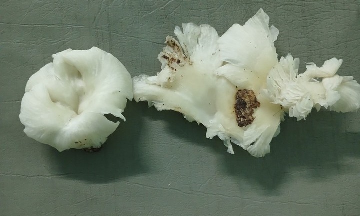 Ăn nấm lạ, 3 người trong một gia đình ở Quảng Nam co giật, trụy tim mạch