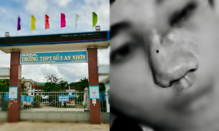 Bị nhóm bạn đánh hội đồng, nam sinh Bình Định gãy xương chính mũi