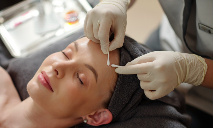 Nặn mụn thế nào để da không bị sẹo?