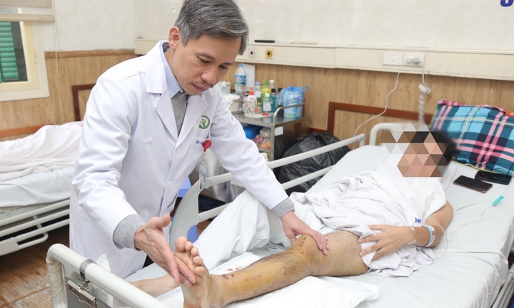 Sĩ quan cảnh sát bị người vi phạm giao thông tông gãy chân rồi tẩu thoát