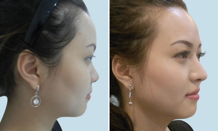 Chuyên gia bệnh viện thẩm mỹ Việt Mỹ tư vấn làm đẹp mùa Tết