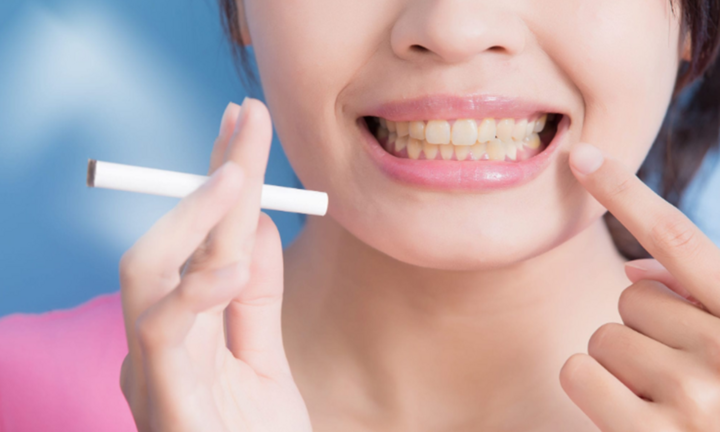 Những thói quen khiến răng bị ố vàng