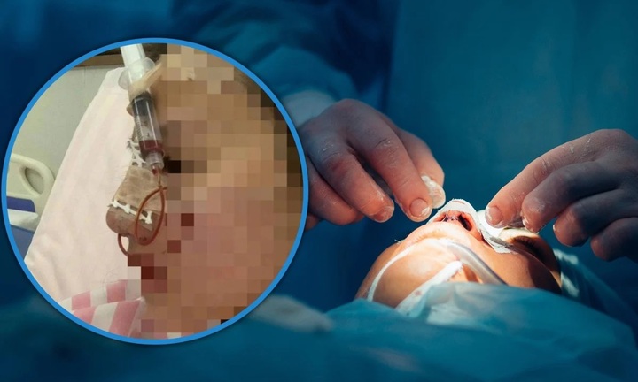 Thẩm mỹ viện tuyển nhân viên để ép sửa mũi với giá cao rồi tìm cớ sa thải