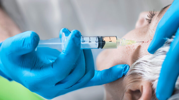 Sốc phản vệ sau khi tiêm tế bào gốc trẻ hóa da 