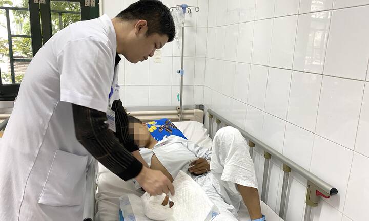 Chơi pháo tự chế, 3 thiếu niên bị nổ nát tay