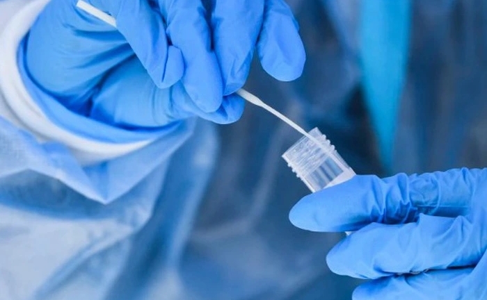 TP.HCM phát hiện biến thể phụ JN.1 ở người mắc COVID-19