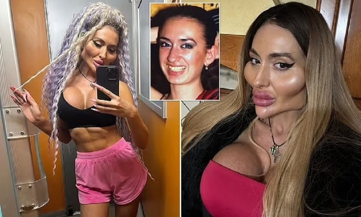 Nhan sắc kỳ lạ của cô gái có gò má to nhất thế giới