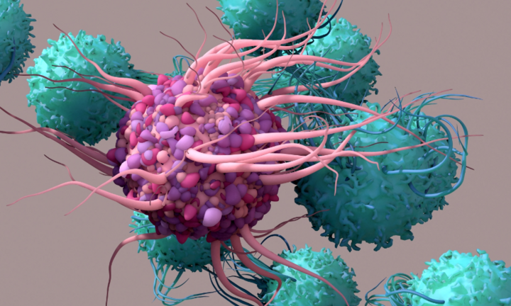 Ô nhiễm không khí có thể làm tăng nguy cơ mắc bệnh ung thư này lên 45%